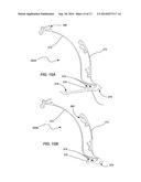 MEDICAL DEVICE FOR MODIFICATION OF LEFT ATRIAL APPENDAGE AND RELATED     SYSTEMS AND METHODS diagram and image