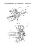 MEDICAL DEVICE FOR MODIFICATION OF LEFT ATRIAL APPENDAGE AND RELATED     SYSTEMS AND METHODS diagram and image