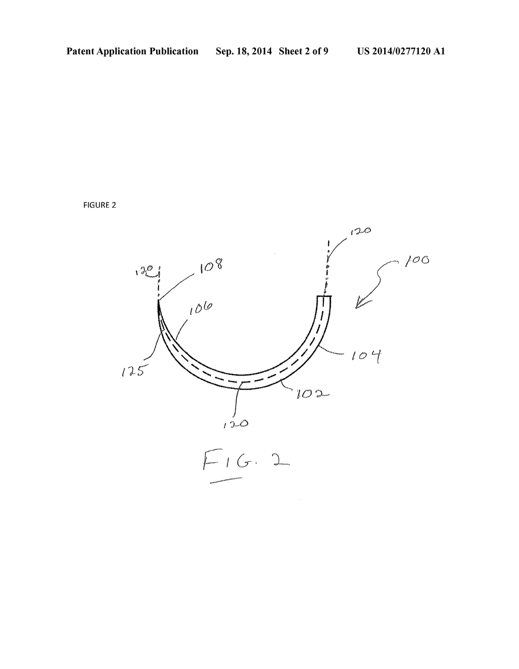 METHOD OF COATING SURGICAL NEEDLES - diagram, schematic, and image 03