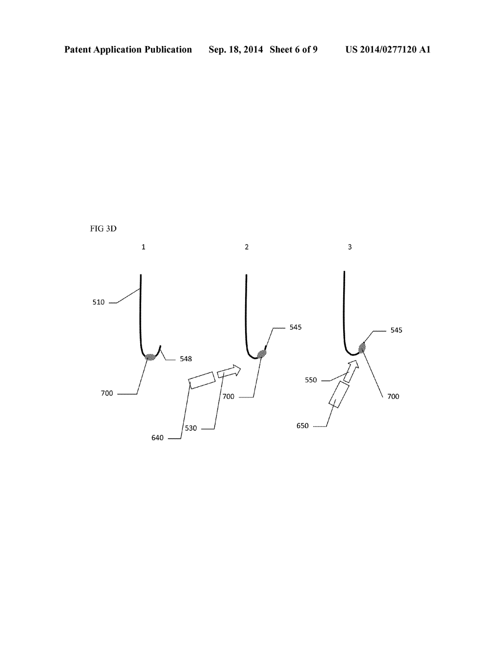 METHOD OF COATING SURGICAL NEEDLES - diagram, schematic, and image 07