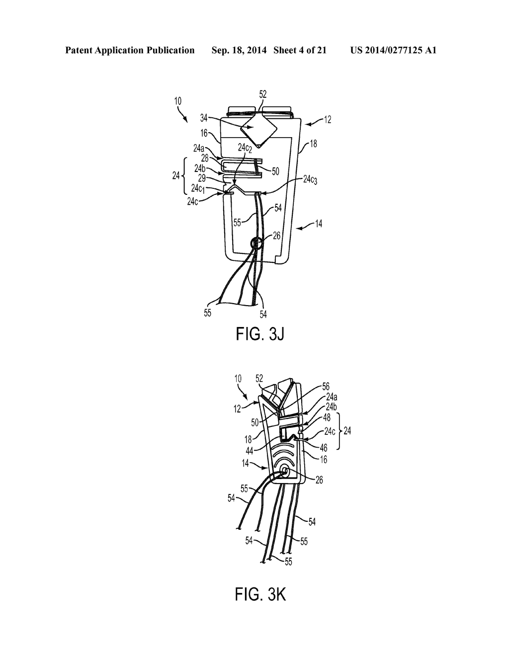 SUTURE STORAGE DEVICES, SYSTEMS, AND METHODS - diagram, schematic, and image 05