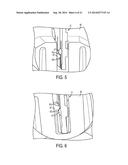 SUTURE STORAGE DEVICES, SYSTEMS, AND METHODS diagram and image