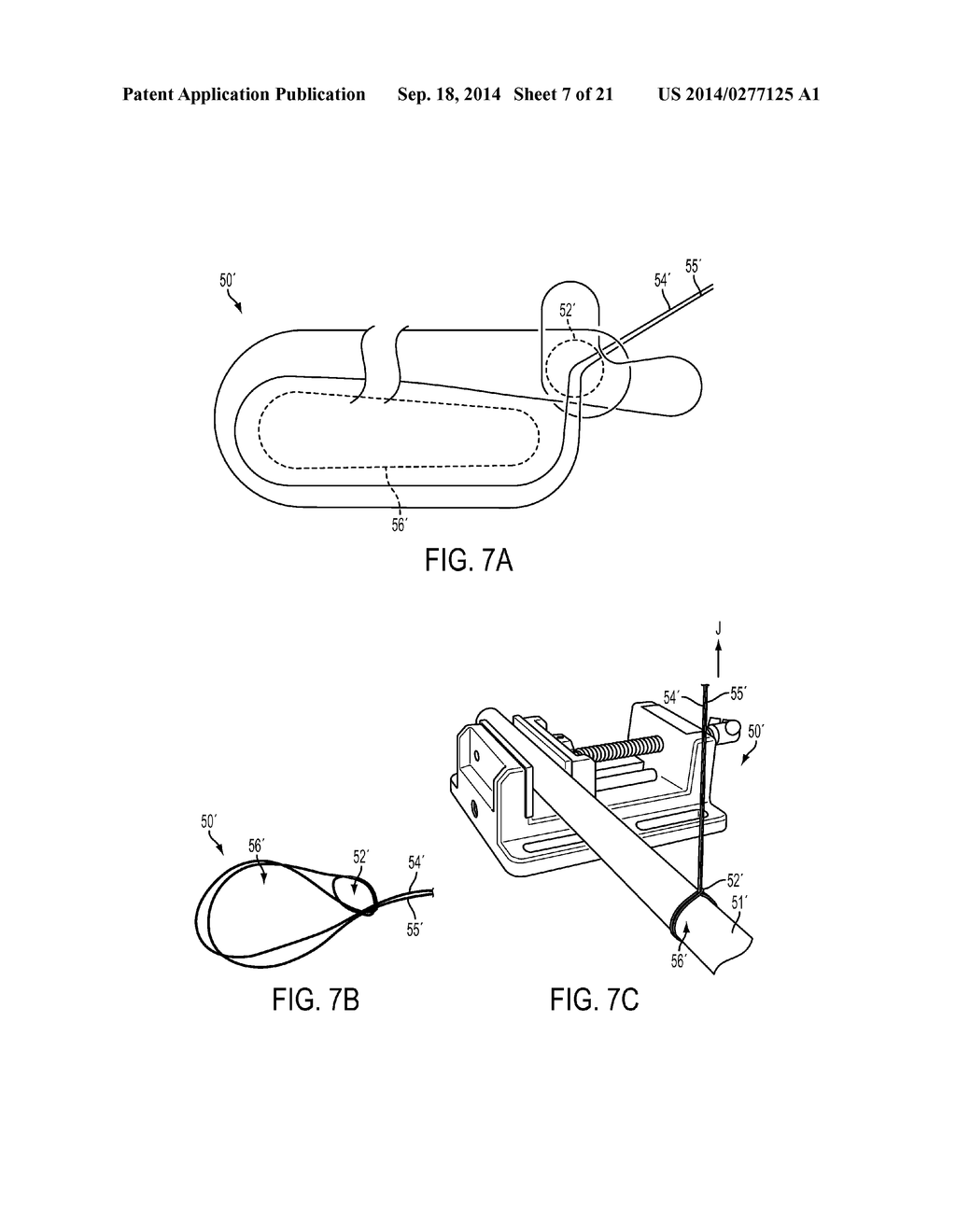 SUTURE STORAGE DEVICES, SYSTEMS, AND METHODS - diagram, schematic, and image 08