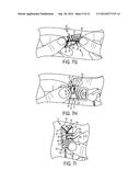 SUTURE STORAGE DEVICES, SYSTEMS, AND METHODS diagram and image