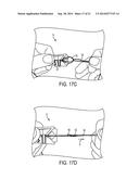 SUTURE STORAGE DEVICES, SYSTEMS, AND METHODS diagram and image