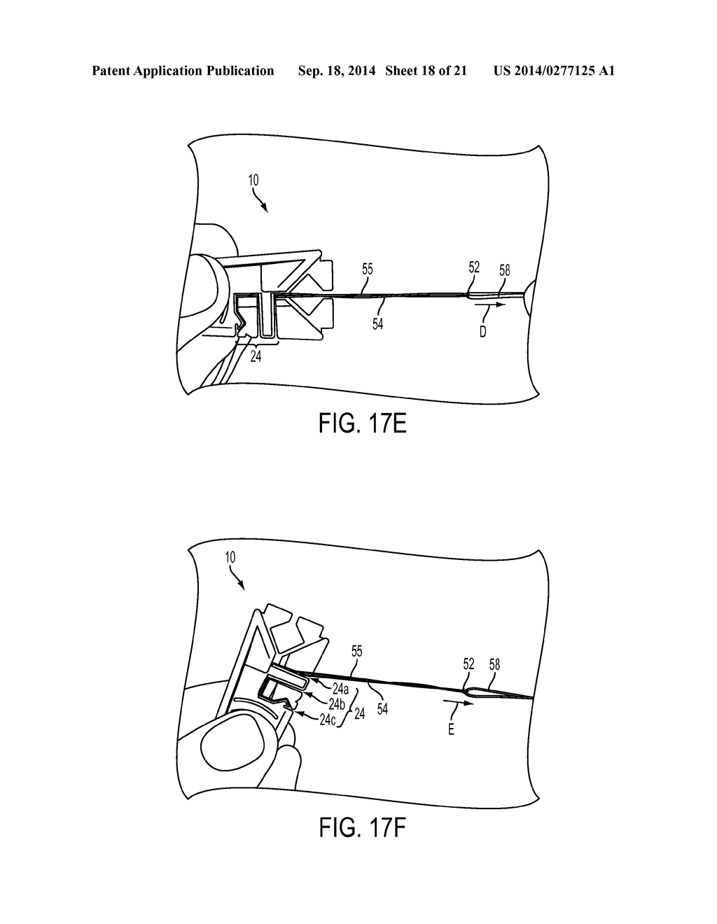 SUTURE STORAGE DEVICES, SYSTEMS, AND METHODS - diagram, schematic, and image 19