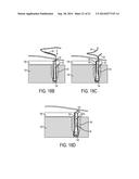 SUTURE STORAGE DEVICES, SYSTEMS, AND METHODS diagram and image