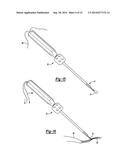 KNOTLESS GRAFT FIXATION ASSEMBLY diagram and image