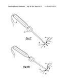 KNOTLESS GRAFT FIXATION ASSEMBLY diagram and image