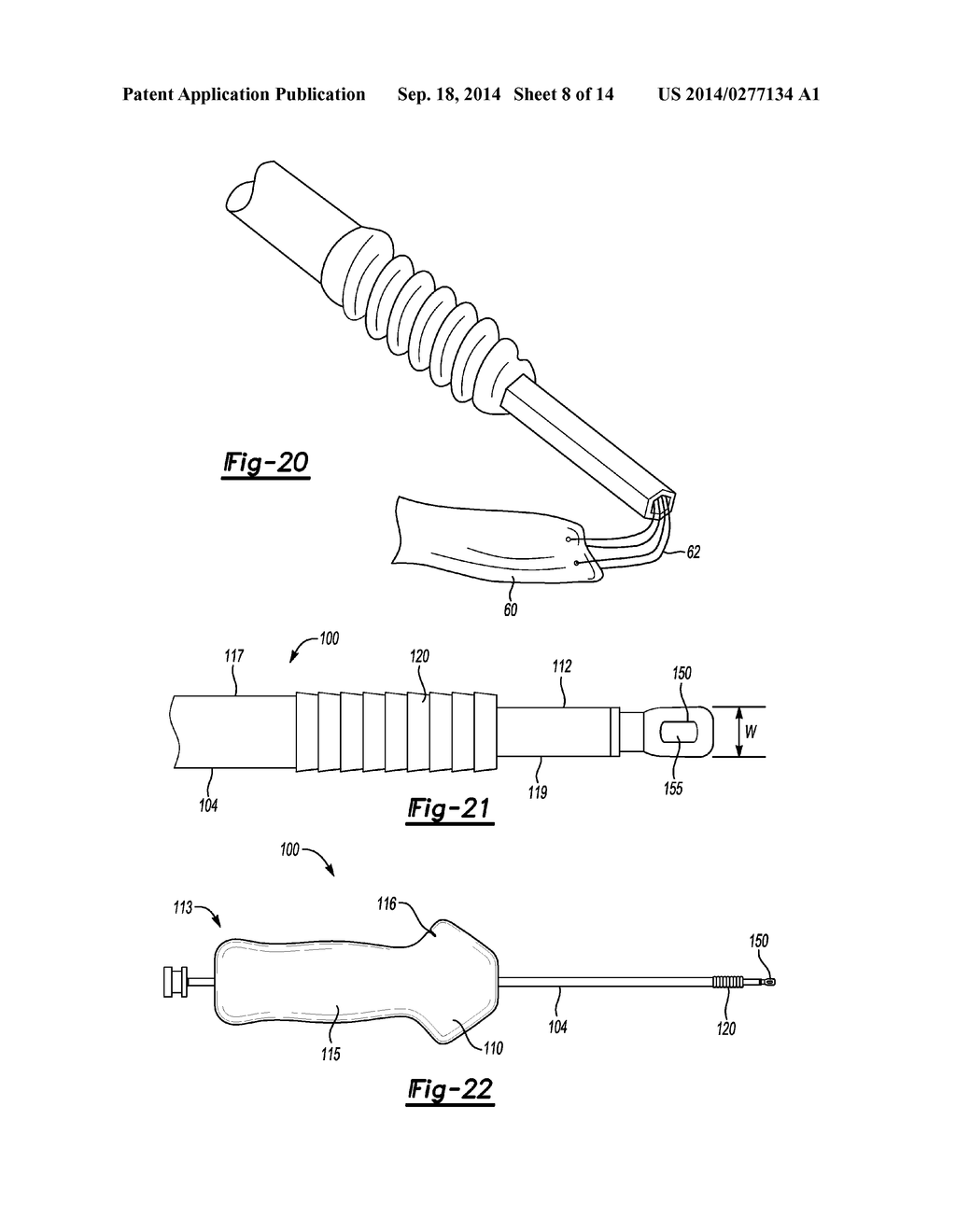 KNOTLESS GRAFT FIXATION ASSEMBLY - diagram, schematic, and image 09