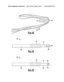 KNOTLESS GRAFT FIXATION ASSEMBLY diagram and image