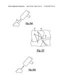 KNOTLESS GRAFT FIXATION ASSEMBLY diagram and image