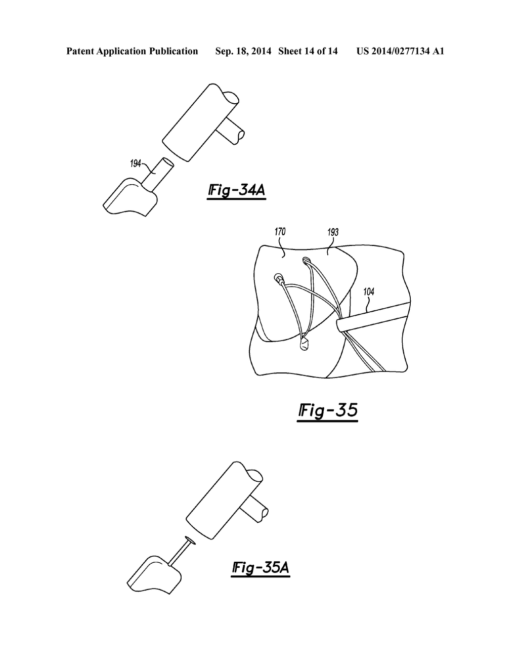 KNOTLESS GRAFT FIXATION ASSEMBLY - diagram, schematic, and image 15