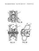 Spinous Process Fixation System and Methods Thereof diagram and image