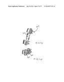 Spinous Process Fixation System and Methods Thereof diagram and image