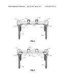 SYSTEMS AND METHODS FOR SPINAL COMPRESSION, DISTRACTION, AND FIXATION diagram and image