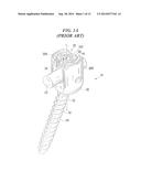 Bone Anchor Assemblies and Methods With Improved Locking diagram and image