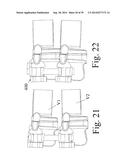 DEVICES AND METHODS FOR DYNAMIC FIXATION OF SKELETAL STRUCTURE diagram and image