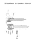 DEVICES AND METHODS FOR DYNAMIC FIXATION OF SKELETAL STRUCTURE diagram and image