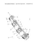 Anterior Cervical Instrumentation Systems, Methods And Devices diagram and image