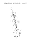 Posterior Ankle Fusion Plate diagram and image