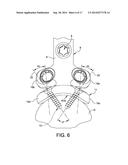 Posterior Ankle Fusion Plate diagram and image