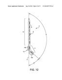 Posterior Ankle Fusion Plate diagram and image