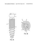 BONE ANCHOR ASSEMBLIES WITH MULTIPLE COMPONENT BOTTOM LOADING BONE ANCHORS diagram and image