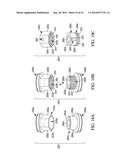 ARTHRODESIS DEVICE AND METHOD OF USE diagram and image