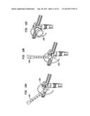 METHODS AND DEVICES FOR POLYAXIAL SCREW ALIGNMENT diagram and image