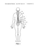 IMPLANTABLE DEVICE WITH INTERNAL LEAD CONNECTOR diagram and image