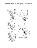 IMPLANTABLE DEVICE WITH INTERNAL LEAD CONNECTOR diagram and image