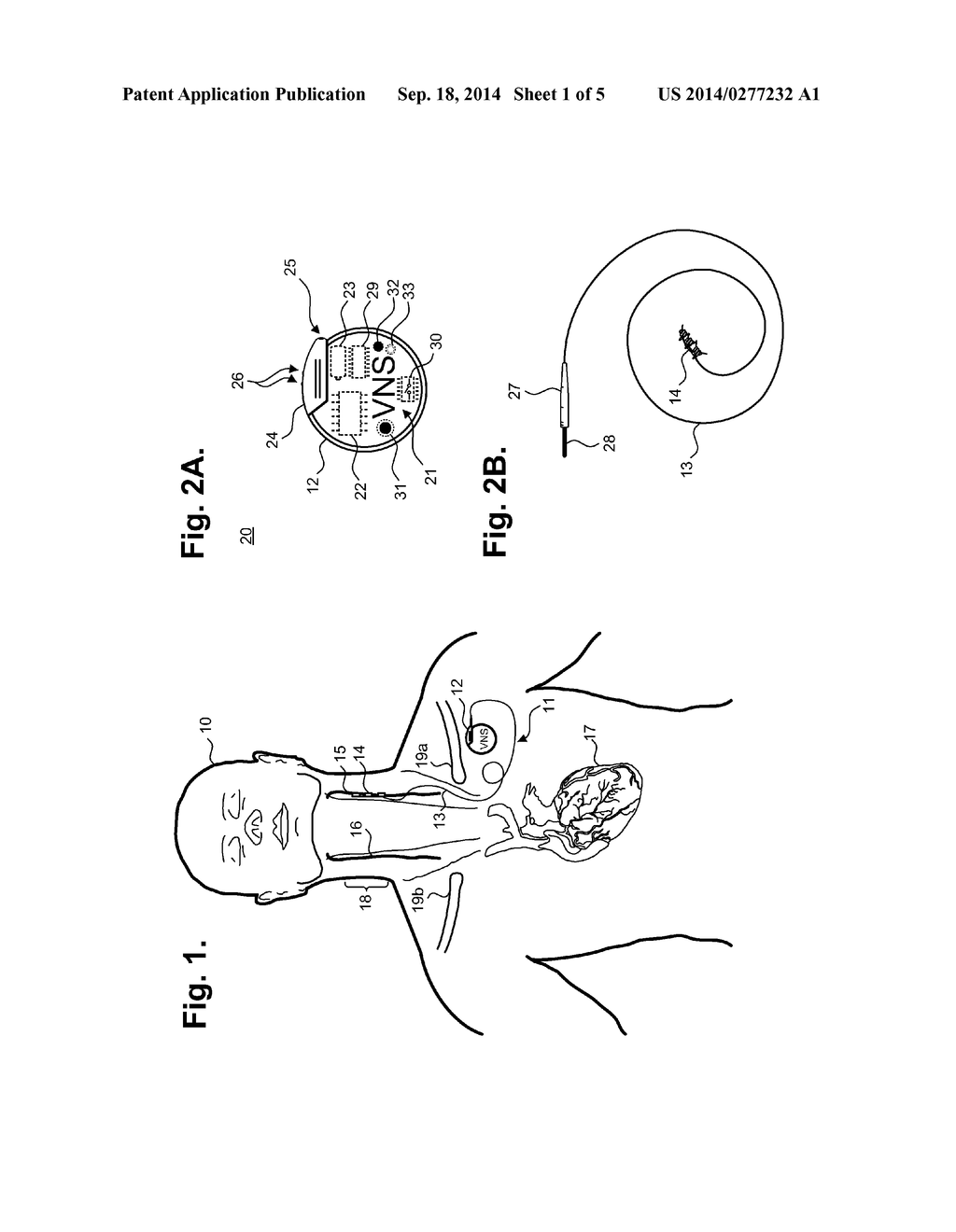 IMPLANTABLE NEUROSTIMULATOR-IMPLEMENTED METHOD FOR MANAGING     TACHYARRHYTHMIC RISK DURING SLEEP THROUGH VAGUS NERVE STIMULATION - diagram, schematic, and image 02