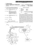 SYSTEM AND METHODS FOR IMPROVING DEVICE THERAPY USING HEART SOUNDS diagram and image