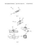 Spinal Cord Stimulator System diagram and image