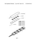 Spinal Cord Stimulator System diagram and image