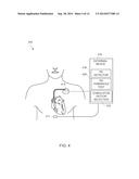 PHRENIC NERVE STIMULATION DETECTION WITH POSTURE SENSING diagram and image