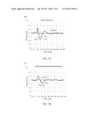 PHRENIC NERVE STIMULATION DETECTION WITH POSTURE SENSING diagram and image