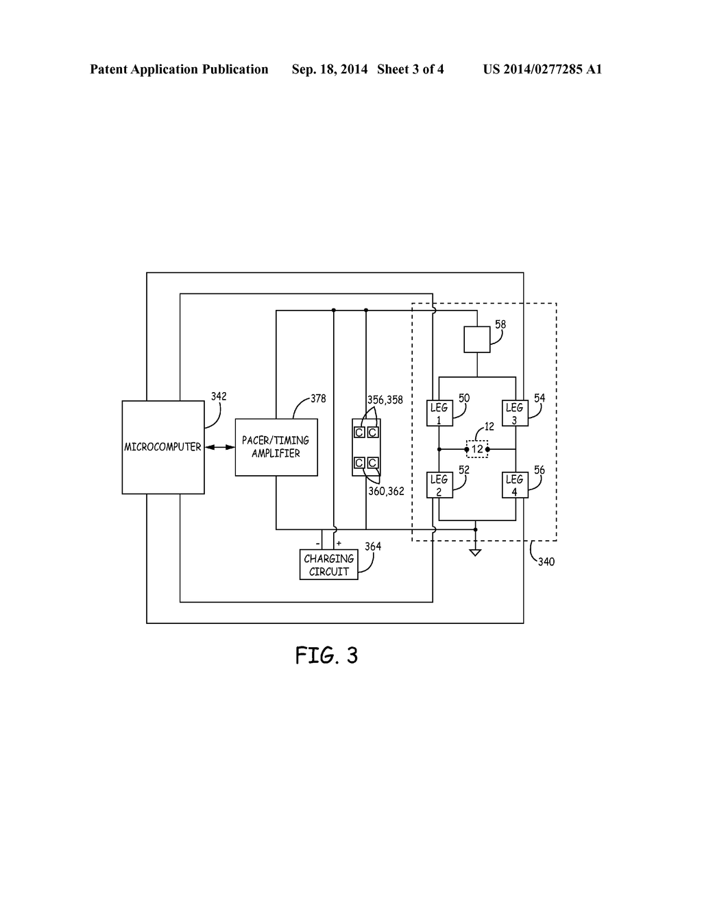 SUBTHRESHOLD LEAD IMPEDANCE MEASUREMENT FOR SUBCUTANEOUS DEVICE - diagram, schematic, and image 04