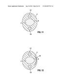 Implantable Electrode diagram and image