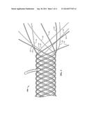 SECURED STRAND END DEVICES diagram and image