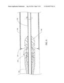 LOADING TOOL FOR CAPTURING STENT POINTS diagram and image