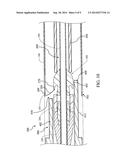 LOADING TOOL FOR CAPTURING STENT POINTS diagram and image