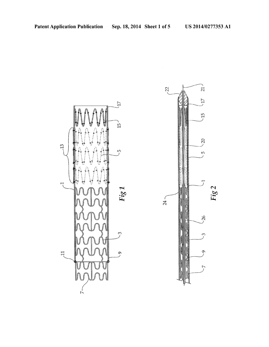 COMPOSITE STENT GRAFT - diagram, schematic, and image 02