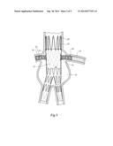 COMPOSITE STENT GRAFT diagram and image