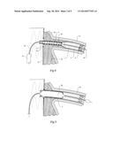 COMPOSITE STENT GRAFT diagram and image