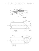 OBLIQUE STENT diagram and image