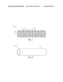 Method for Manufacturing a Stent and Stent Manufactured Thereby diagram and image