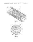 ELECTROPOLISHING OF ALLOYS CONTAINING PLATINUM AND OTHER PRECIOUS METALS diagram and image