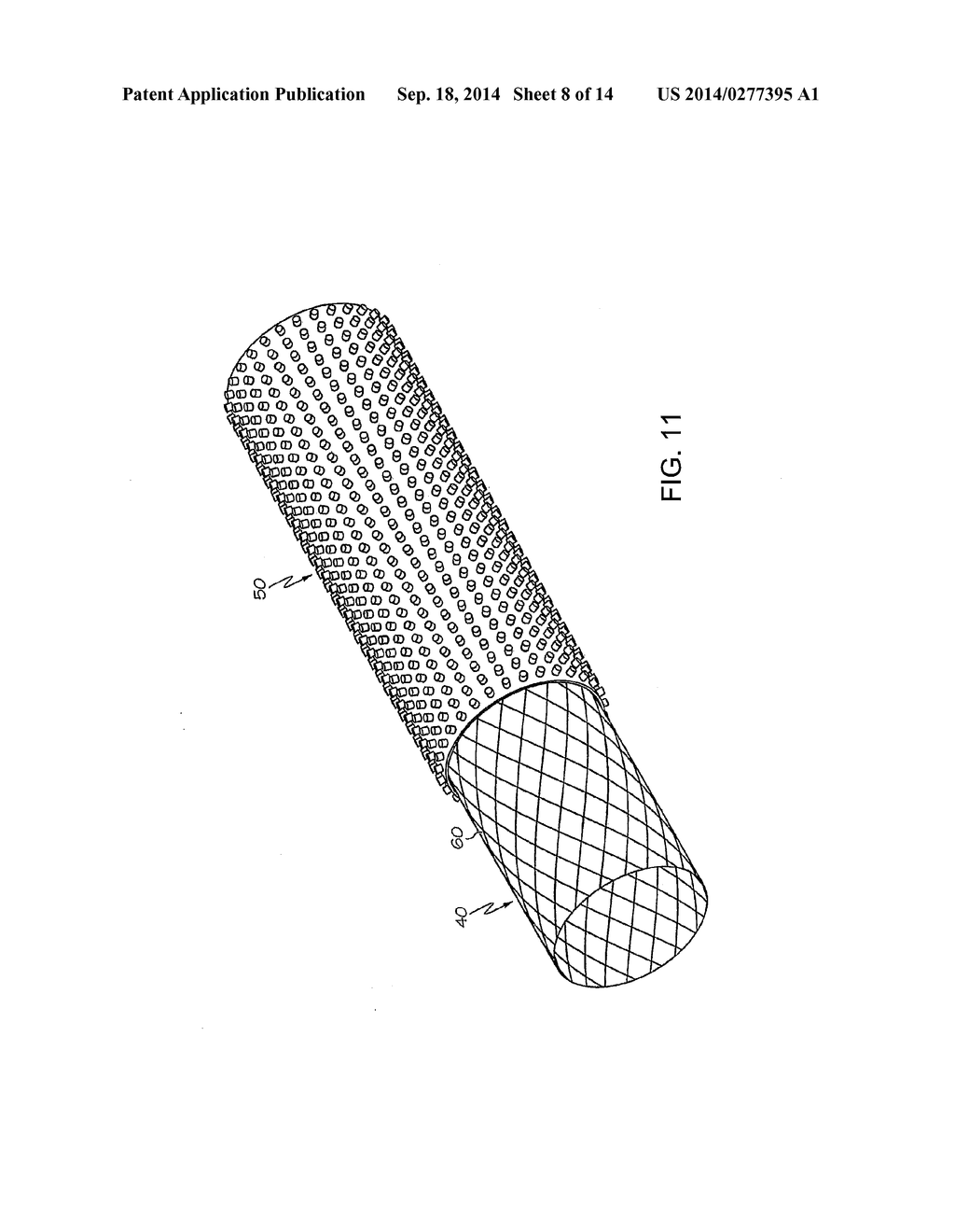 ANTI-MIGRATION MICROPATTERNED STENT COATING - diagram, schematic, and image 09